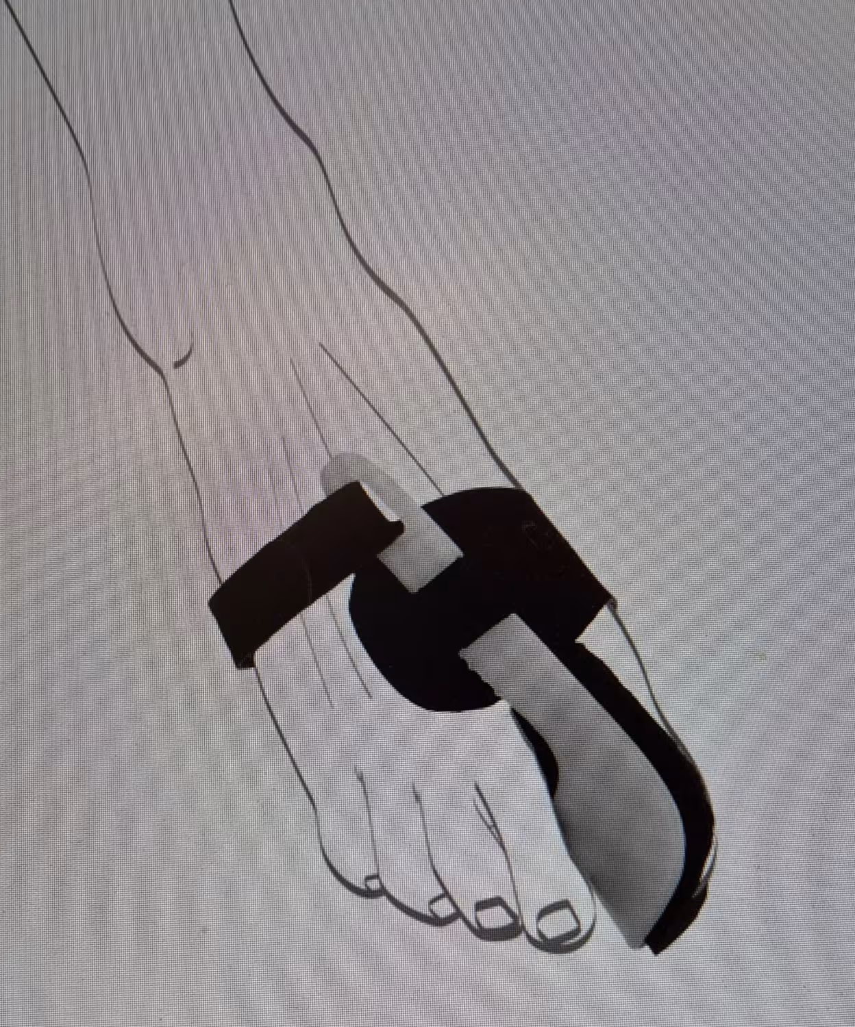 Valex N Nachtbandage Gr. L - Seitengleich (Hallux Valgus Schiene)