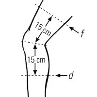 Kniebandage mit Patella-Aussparung silber