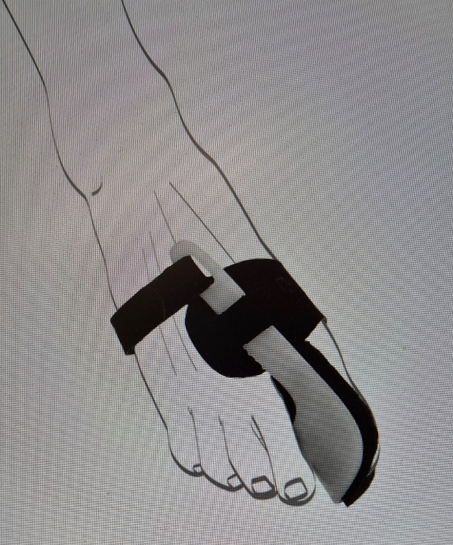 Valex N Nachtbandage Gr. L - Seitengleich (Hallux Valgus Schiene)